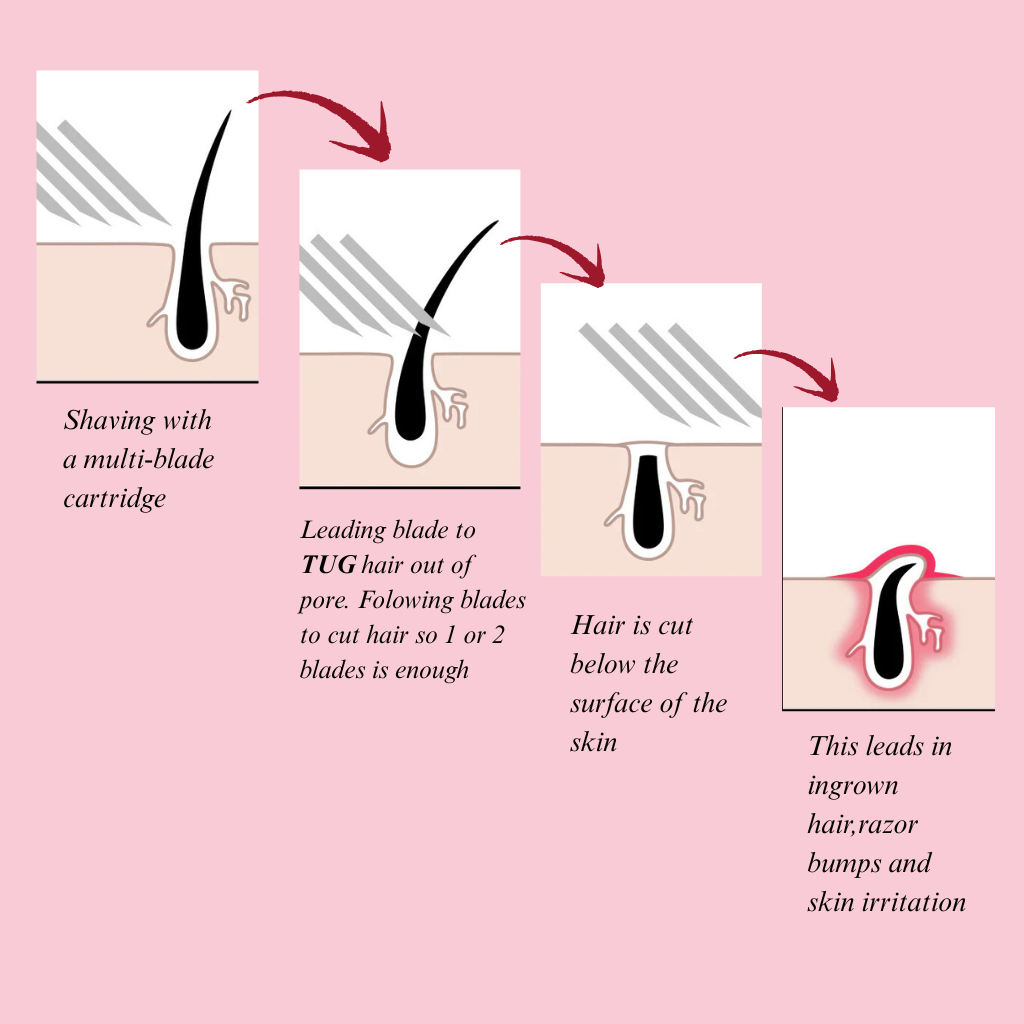 how ingrown hair and strawberry skin develops