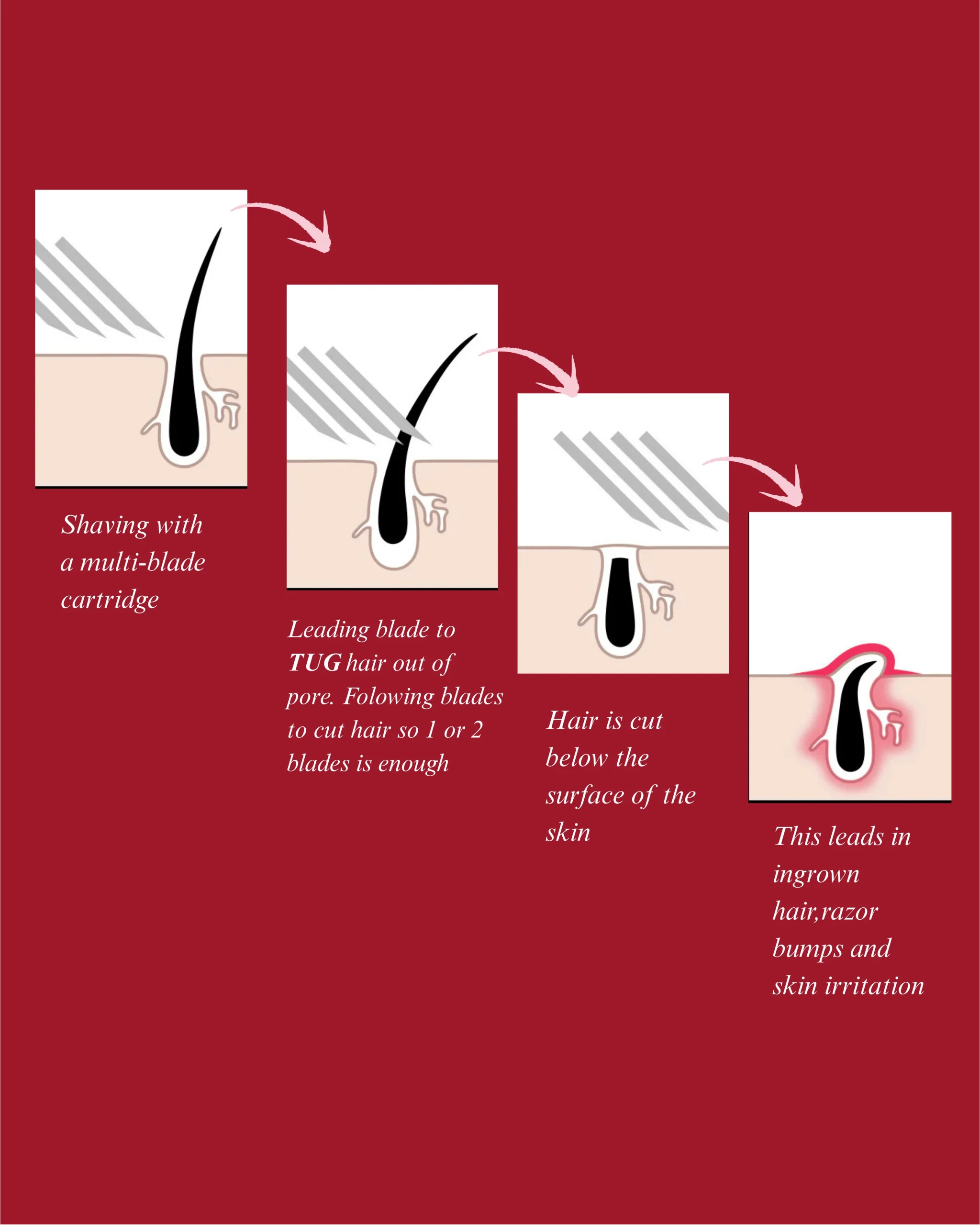 what causes ingrown hair and strawberry skin