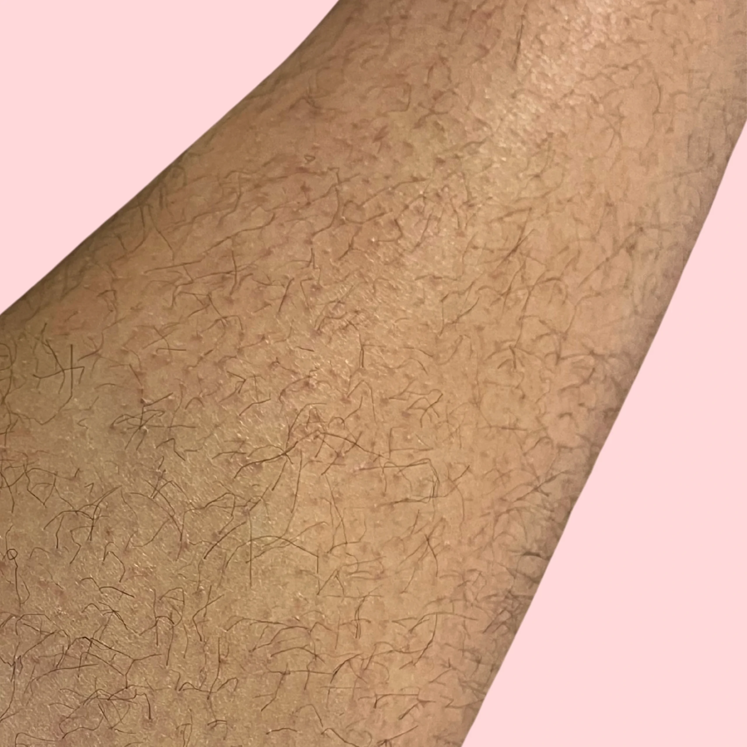 Preventing ingrown hair and razor bump. How to prevent strawberry legs